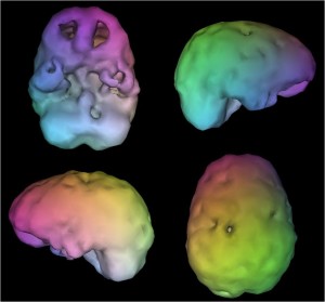 SPECT imaging definition